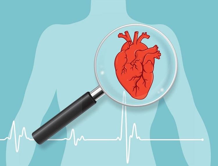 ECG-la-gi