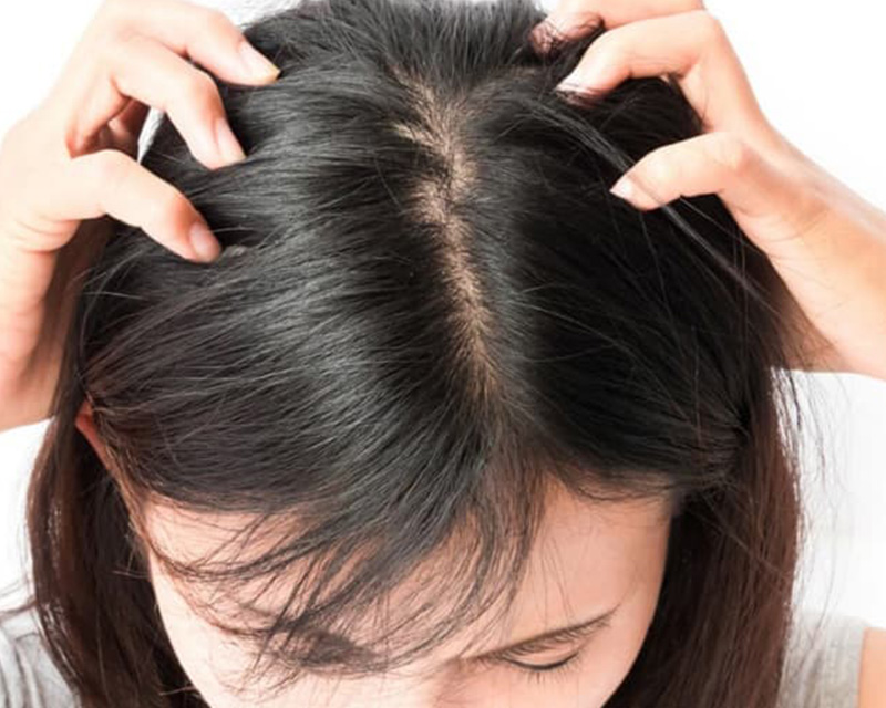 Để tóc ướt trong thời gian lâu sẽ khiến tóc dễ sinh ra gàu